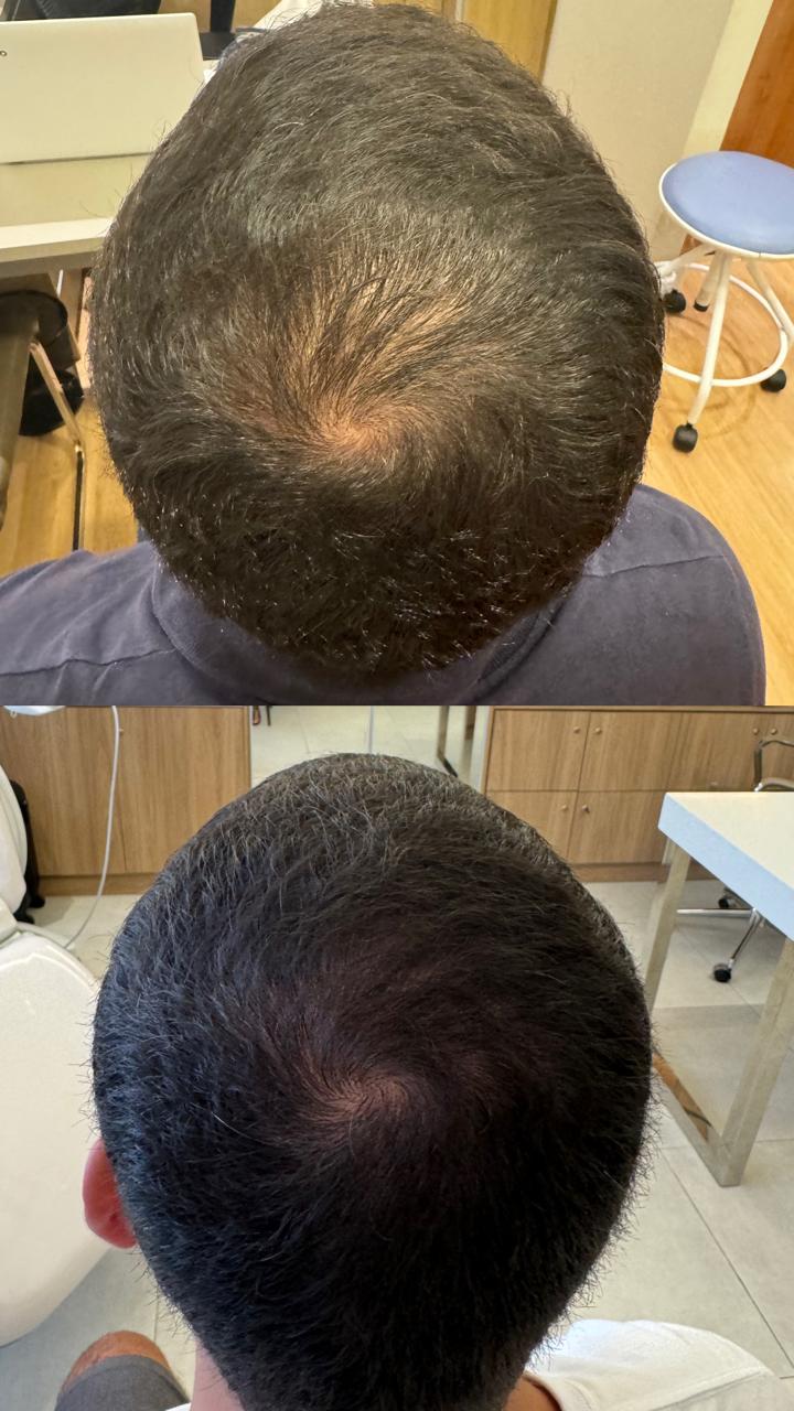 Dra. Melina Rocha: Dermatologia, Tricologia e Estética em Ipanema, Rio de Janeiro | Procedimentos estéticos feitos com naturalidade e segurança | Dermatologista em Ipanema | Dermatologista no Rio de Janeiro | Procedimentos Estéticos em Ipanema | Procedimentos Estéticos no Rio de Janeiro | Tricologista em Ipanema | Tricologista no Rio de Janeiro