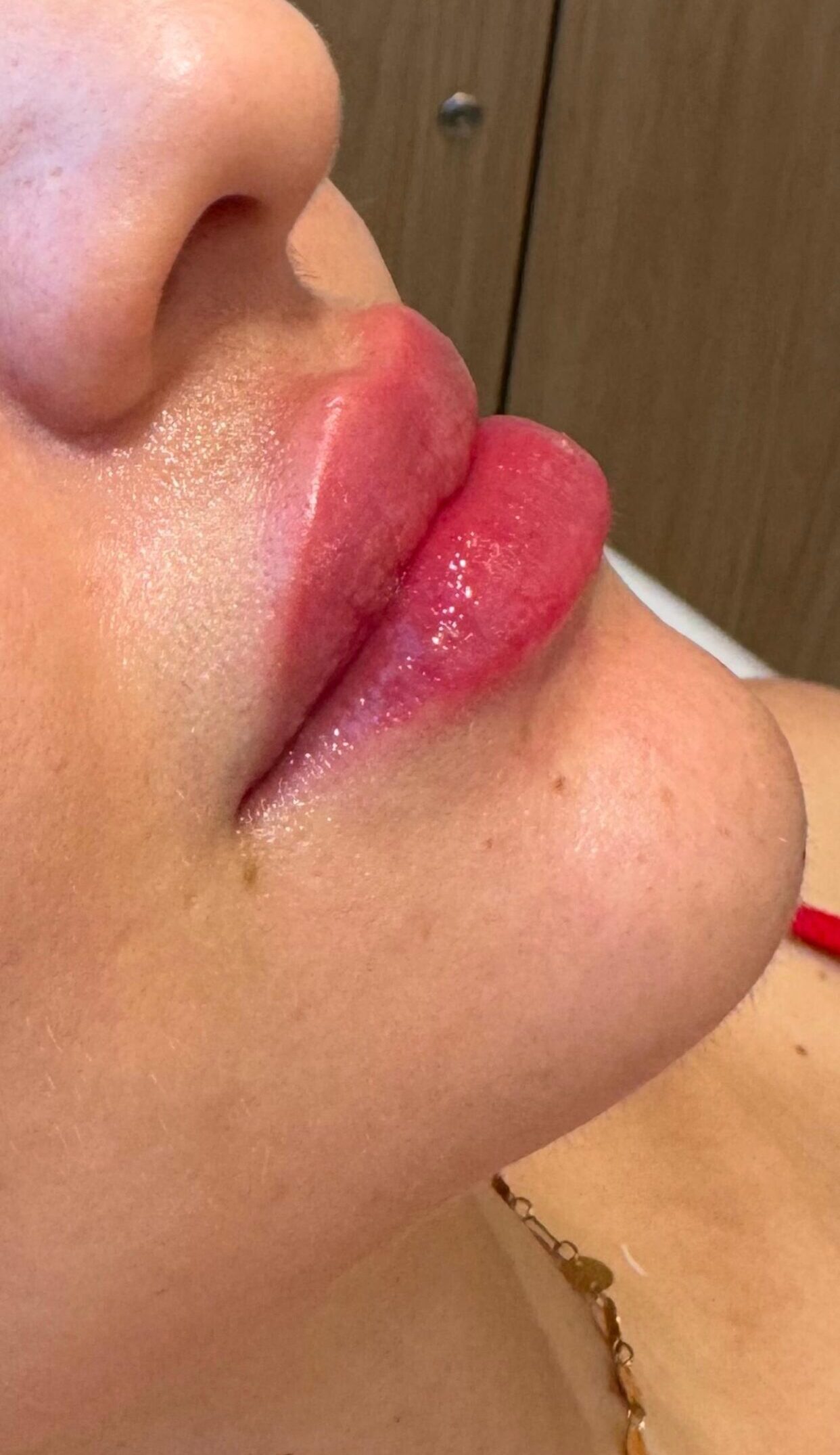 Dra. Melina Rocha: Dermatologia, Tricologia e Estética em Ipanema, Rio de Janeiro | Procedimentos estéticos feitos com naturalidade e segurança | Dermatologista em Ipanema | Dermatologista no Rio de Janeiro | Procedimentos Estéticos em Ipanema | Procedimentos Estéticos no Rio de Janeiro | Tricologista em Ipanema | Tricologista no Rio de Janeiro