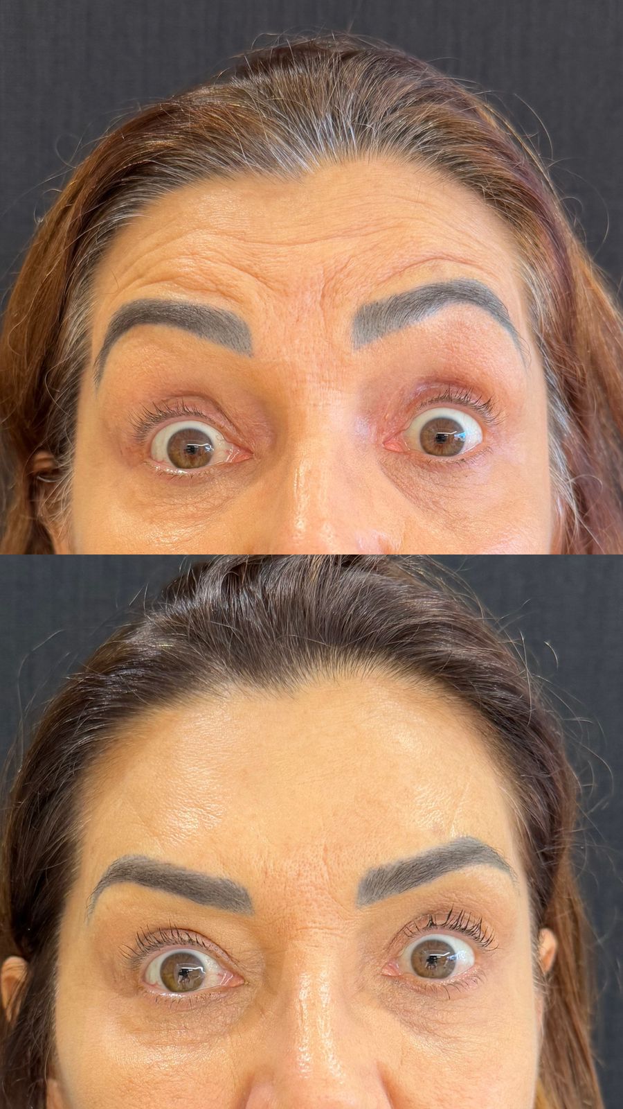 Dra. Melina Rocha: Dermatologia, Tricologia e Estética em Ipanema, Rio de Janeiro | Procedimentos estéticos feitos com naturalidade e segurança | Dermatologista em Ipanema | Dermatologista no Rio de Janeiro | Procedimentos Estéticos em Ipanema | Procedimentos Estéticos no Rio de Janeiro | Tricologista em Ipanema | Tricologista no Rio de Janeiro