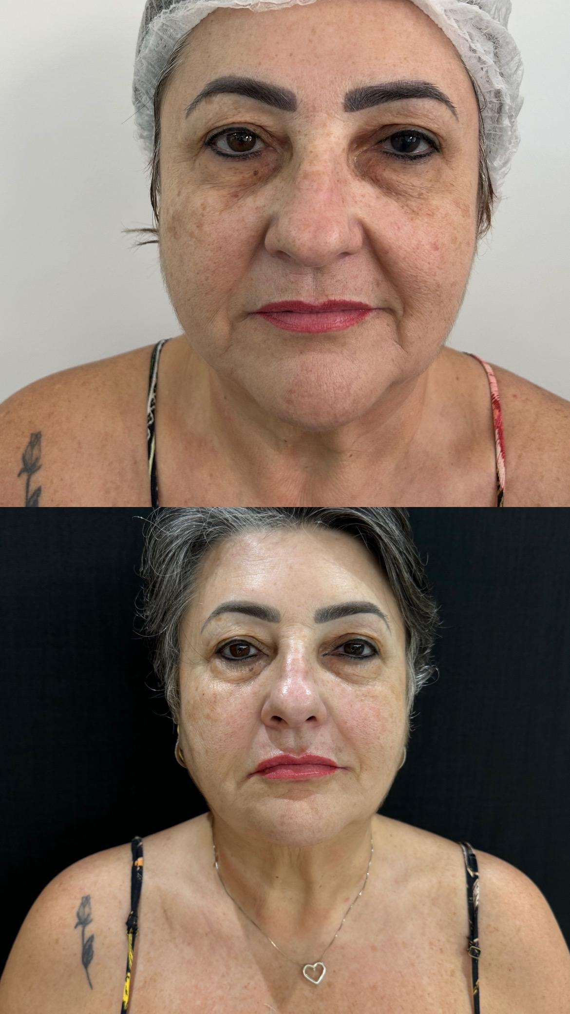 Dra. Melina Rocha: Dermatologia, Tricologia e Estética em Ipanema, Rio de Janeiro | Procedimentos estéticos feitos com naturalidade e segurança | Dermatologista em Ipanema | Dermatologista no Rio de Janeiro | Procedimentos Estéticos em Ipanema | Procedimentos Estéticos no Rio de Janeiro | Tricologista em Ipanema | Tricologista no Rio de Janeiro