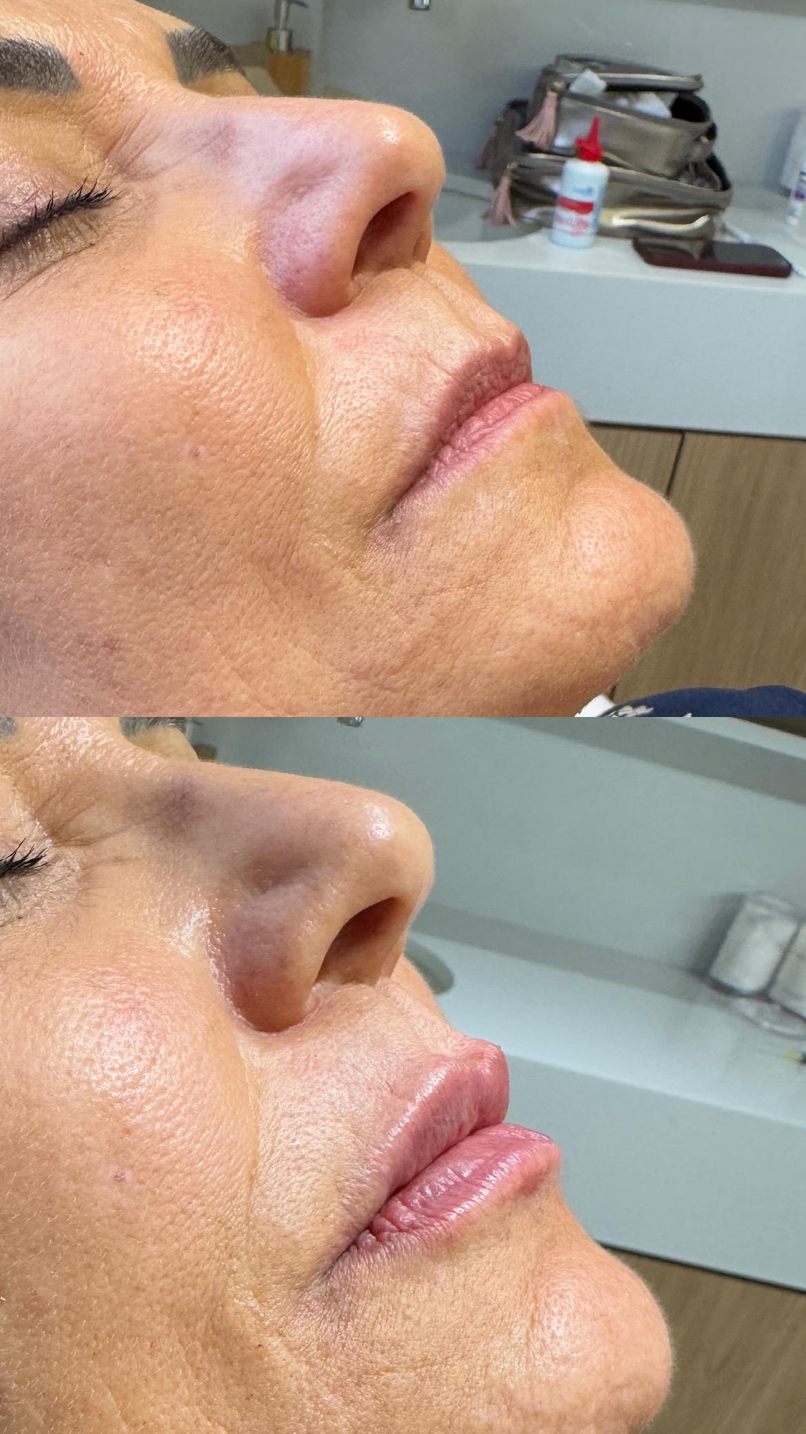 Dra. Melina Rocha: Dermatologia, Tricologia e Estética em Ipanema, Rio de Janeiro | Procedimentos estéticos feitos com naturalidade e segurança | Dermatologista em Ipanema | Dermatologista no Rio de Janeiro | Procedimentos Estéticos em Ipanema | Procedimentos Estéticos no Rio de Janeiro | Tricologista em Ipanema | Tricologista no Rio de Janeiro