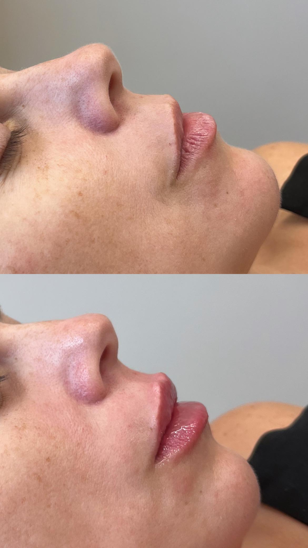 Dra. Melina Rocha: Dermatologia, Tricologia e Estética em Ipanema, Rio de Janeiro | Procedimentos estéticos feitos com naturalidade e segurança | Dermatologista em Ipanema | Dermatologista no Rio de Janeiro | Procedimentos Estéticos em Ipanema | Procedimentos Estéticos no Rio de Janeiro | Tricologista em Ipanema | Tricologista no Rio de Janeiro