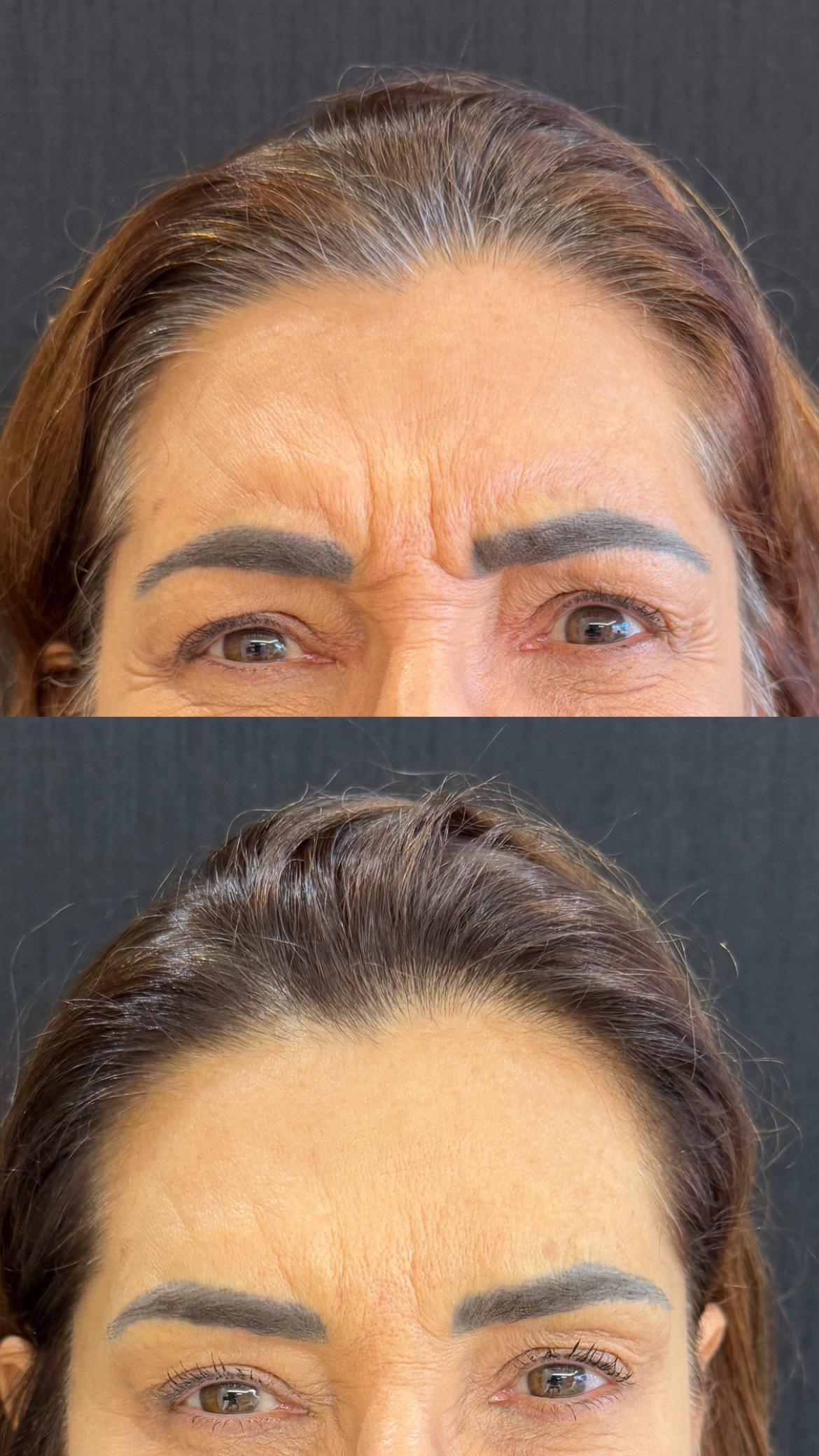 Dra. Melina Rocha: Dermatologia, Tricologia e Estética em Ipanema, Rio de Janeiro | Procedimentos estéticos feitos com naturalidade e segurança | Dermatologista em Ipanema | Dermatologista no Rio de Janeiro | Procedimentos Estéticos em Ipanema | Procedimentos Estéticos no Rio de Janeiro | Tricologista em Ipanema | Tricologista no Rio de Janeiro