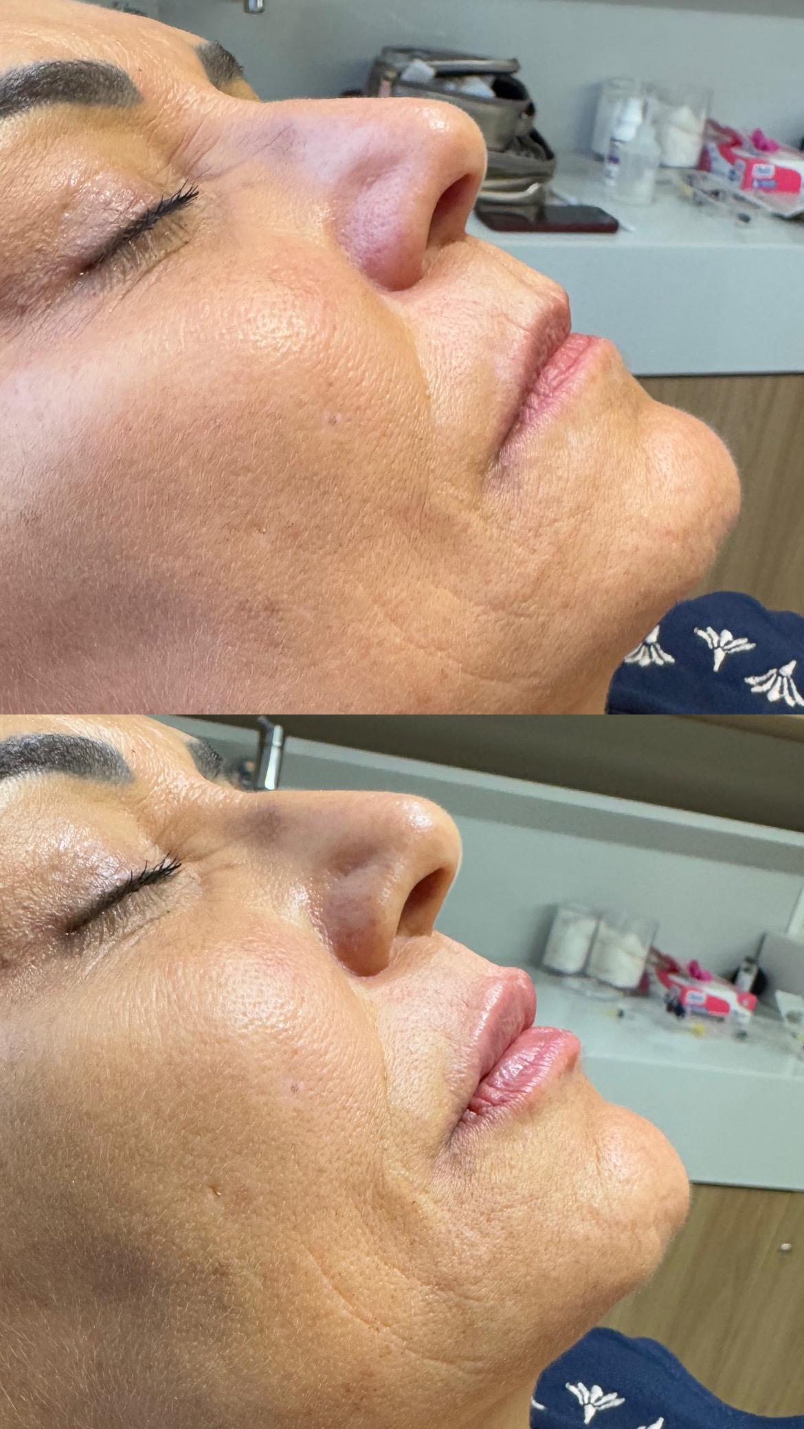 Dra. Melina Rocha: Dermatologia, Tricologia e Estética em Ipanema, Rio de Janeiro | Procedimentos estéticos feitos com naturalidade e segurança | Dermatologista em Ipanema | Dermatologista no Rio de Janeiro | Procedimentos Estéticos em Ipanema | Procedimentos Estéticos no Rio de Janeiro | Tricologista em Ipanema | Tricologista no Rio de Janeiro