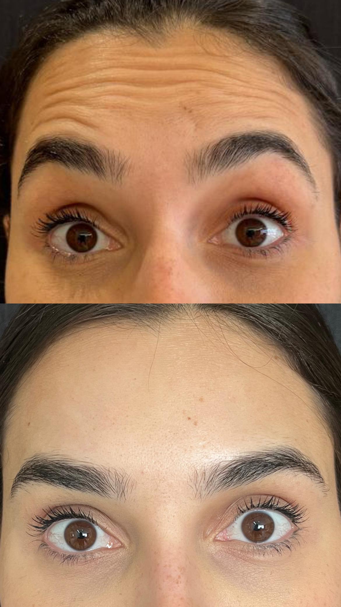 Dra. Melina Rocha: Dermatologia, Tricologia e Estética em Ipanema, Rio de Janeiro | Procedimentos estéticos feitos com naturalidade e segurança | Dermatologista em Ipanema | Dermatologista no Rio de Janeiro | Procedimentos Estéticos em Ipanema | Procedimentos Estéticos no Rio de Janeiro | Tricologista em Ipanema | Tricologista no Rio de Janeiro