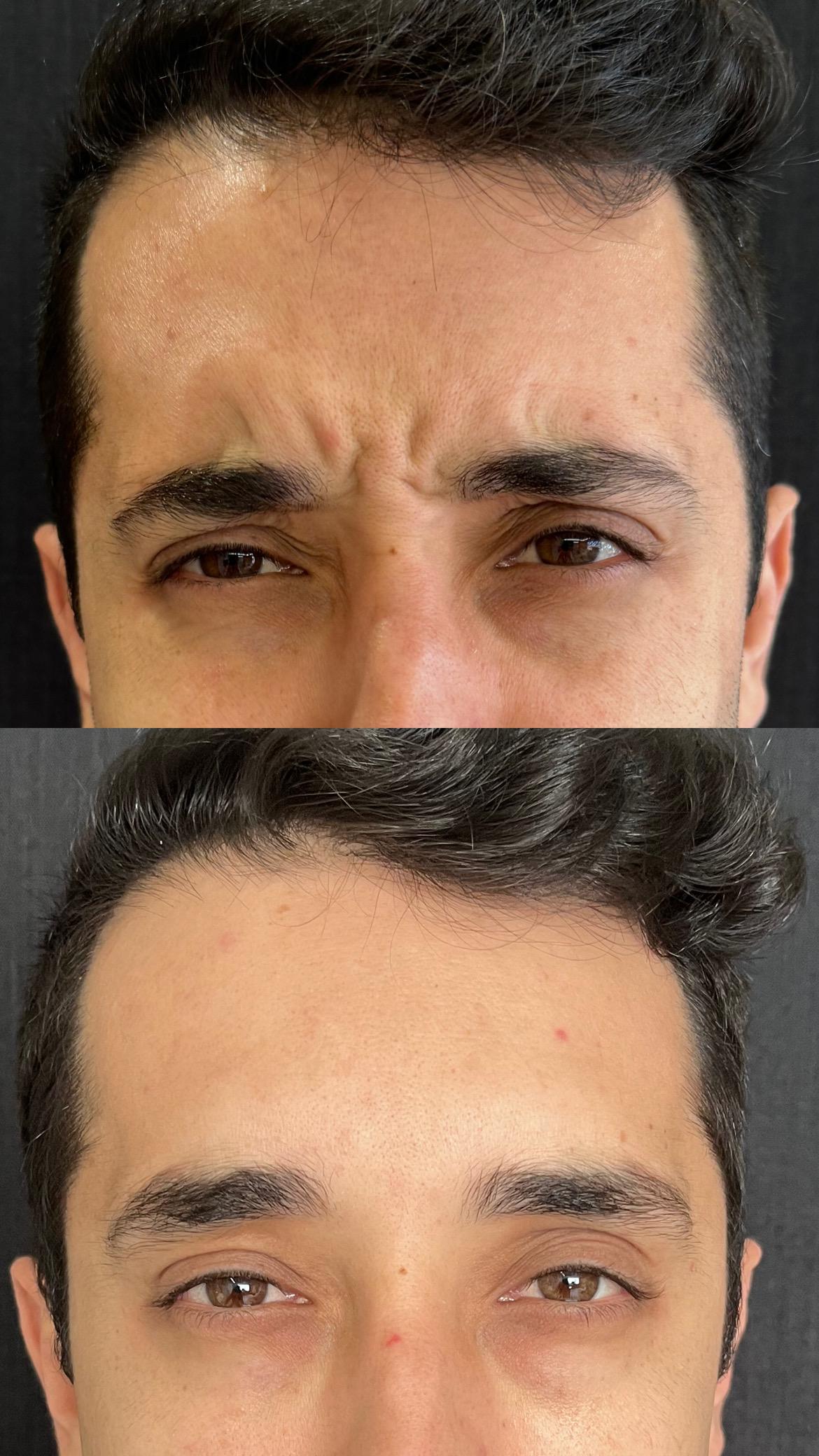 Dra. Melina Rocha: Dermatologia, Tricologia e Estética em Ipanema, Rio de Janeiro | Procedimentos estéticos feitos com naturalidade e segurança | Dermatologista em Ipanema | Dermatologista no Rio de Janeiro | Procedimentos Estéticos em Ipanema | Procedimentos Estéticos no Rio de Janeiro | Tricologista em Ipanema | Tricologista no Rio de Janeiro