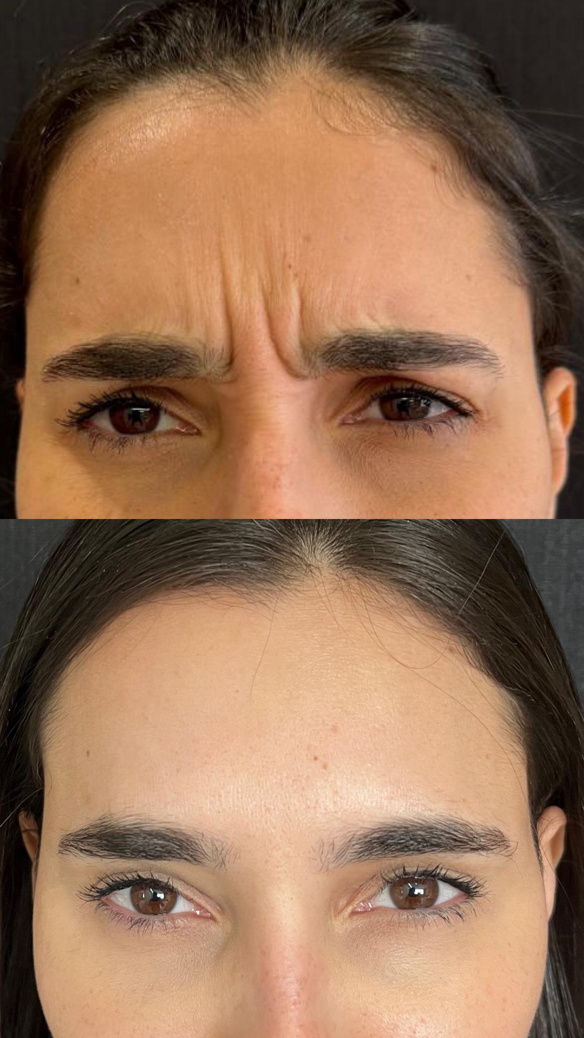 Dra. Melina Rocha: Dermatologia, Tricologia e Estética em Ipanema, Rio de Janeiro | Procedimentos estéticos feitos com naturalidade e segurança | Dermatologista em Ipanema | Dermatologista no Rio de Janeiro | Procedimentos Estéticos em Ipanema | Procedimentos Estéticos no Rio de Janeiro | Tricologista em Ipanema | Tricologista no Rio de Janeiro